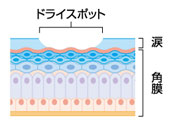 ドライアイの方