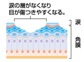 ドライアイの方