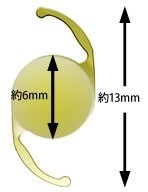 彩光会グループが採用している単焦点レンズについて